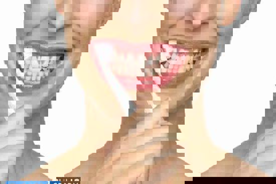 Koliko često biste trebali ići kod stomatologa