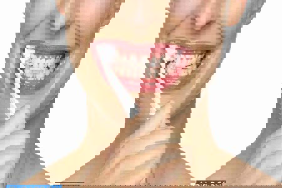 Koliko često biste trebali ići kod stomatologa